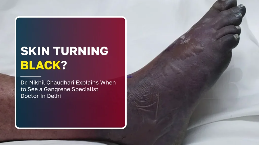 Skin Turning Black? Dr. Nikhil Chaudhari Explains When to See a Gangrene Specialist Doctor In Delhi