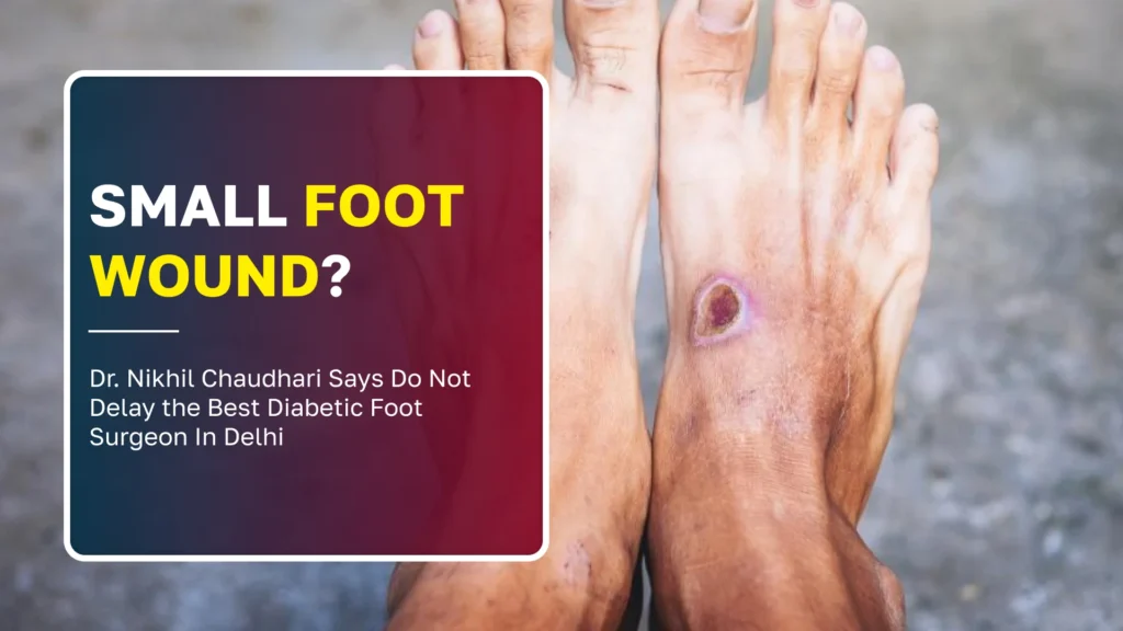 Small Foot Wound? Dr. Nikhil Chaudhari Answers: When Should You See the Best Diabetic Foot Surgeon In Delhi?