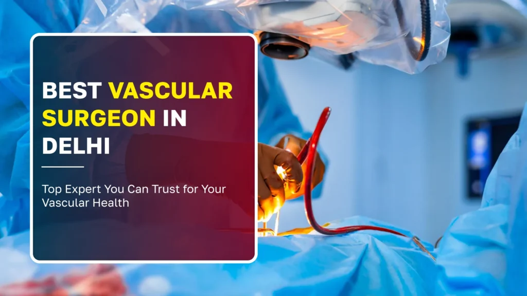 Best Vascular Surgeon in Delhi: Top Expert You Can Trust for Your Vascular Health