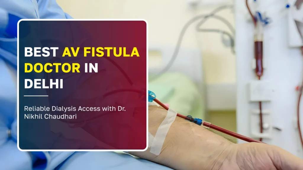Best AV Fistula Doctor in Delhi: Reliable Dialysis Access with Dr. Nikhil Chaudhari