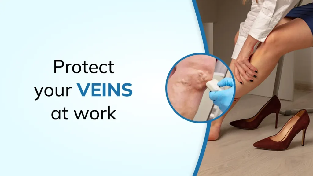 Standing All Day at Work? Here’s How Teachers, Nurses and Retail Workers Can Protect Their Veins