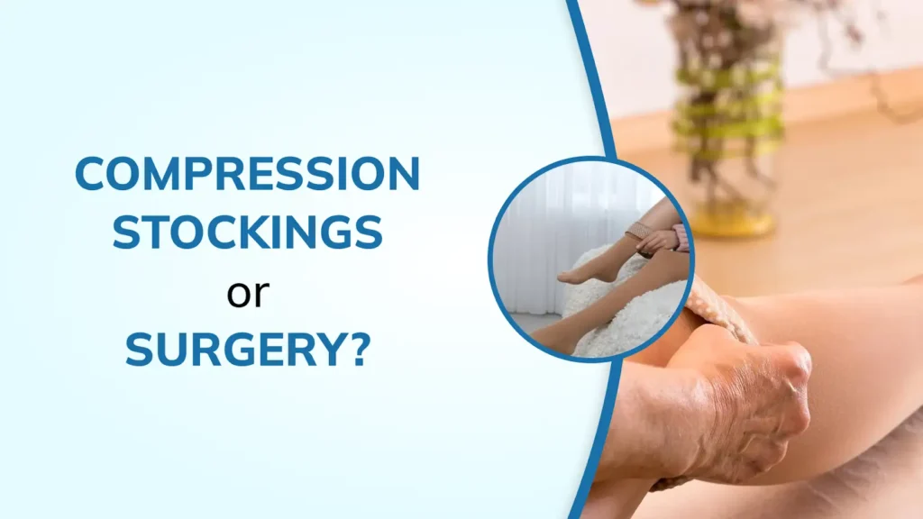 Are Compression Stockings Enough or Do You Need a Vascular Surgeon?