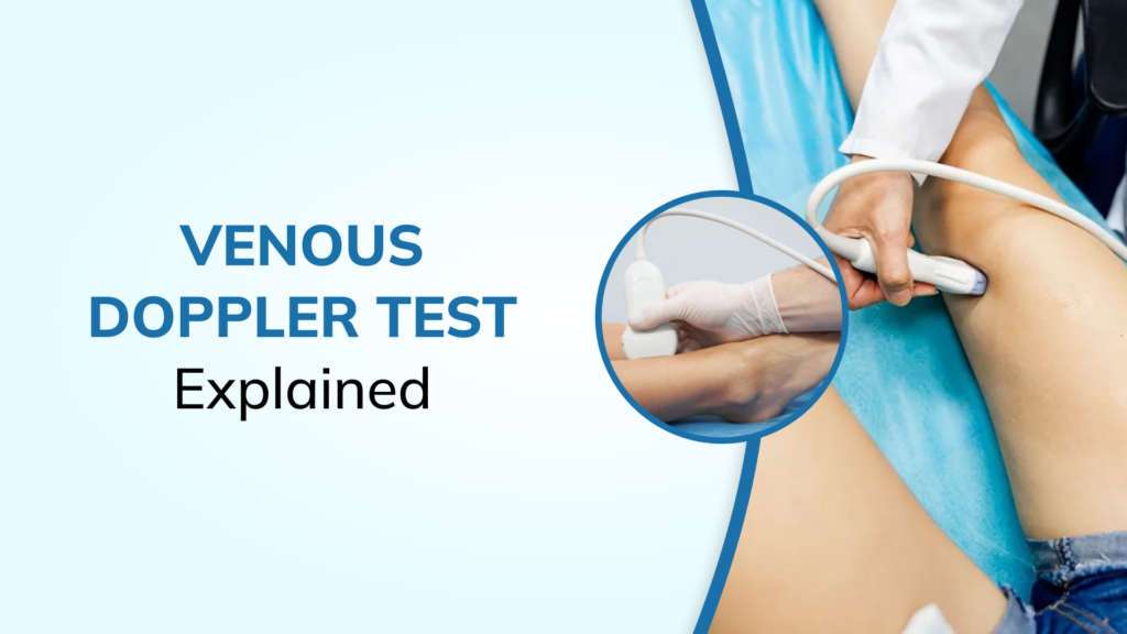 What Happens During a Venous Doppler Ultrasound? A First-Time Patient Guide