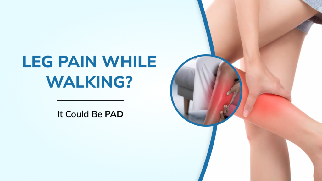 Why Does My Leg Hurt Only While Walking? Understanding Peripheral Artery Disease