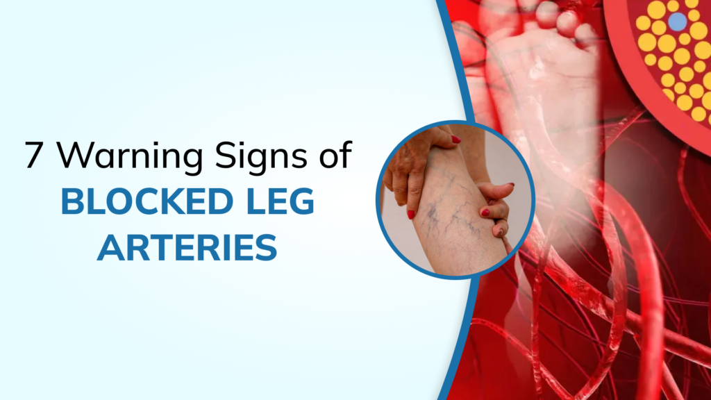 Blocked Arteries in the Legs: 7 Early Warning Signs You Should Never Ignore