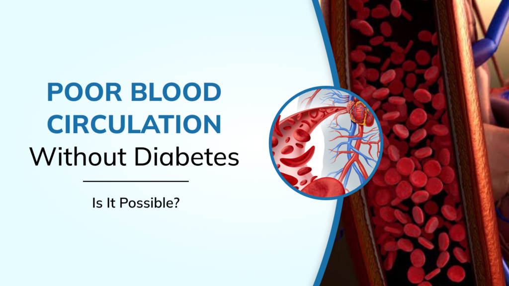 Can You Have Poor Blood Circulation Even If You Don’t Have Diabetes?