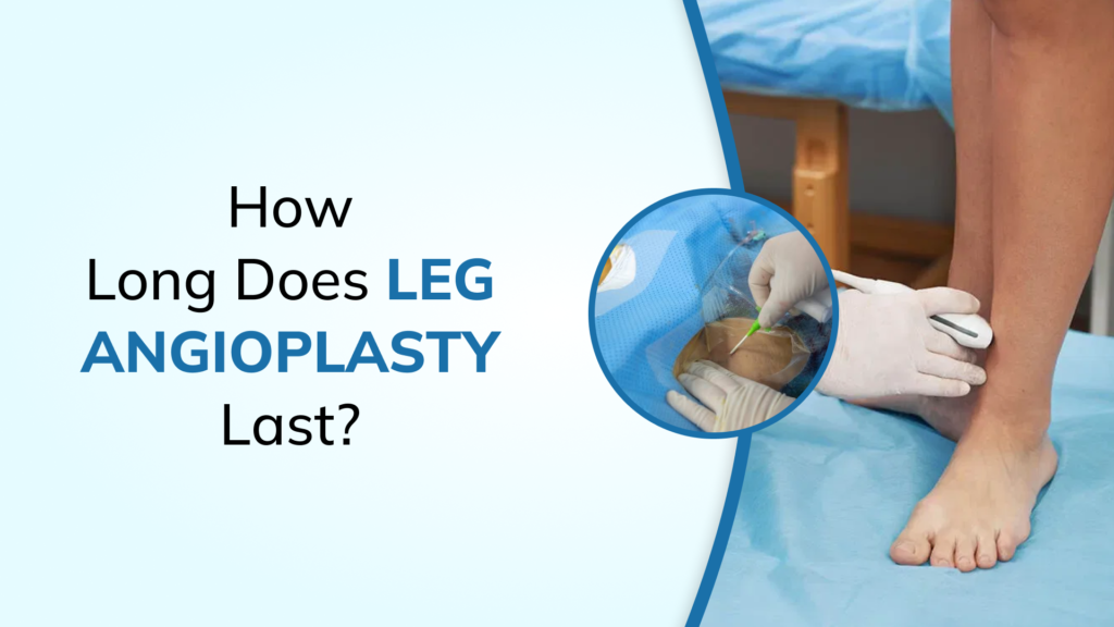 How Long Does a Leg Angioplasty Last? Recovery, Success Rate & Long-Term Results