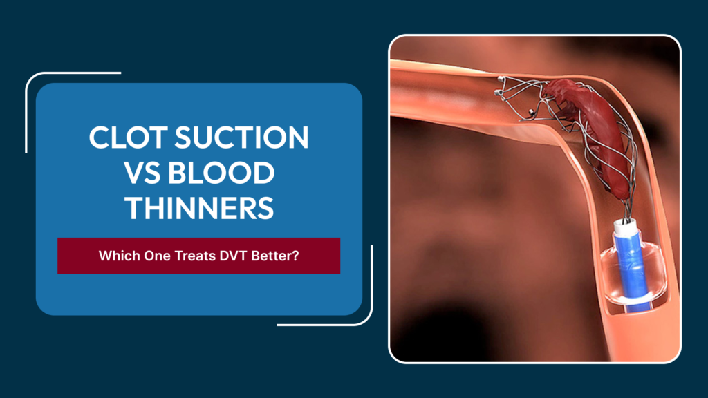 Clot Suction for DVT vs Blood Thinners: When Is Mechanical Thrombectomy Considered for Extensive Deep Vein Thrombosis?