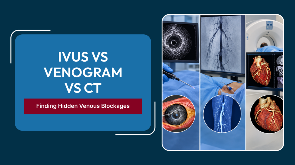 IVUS vs Venogram vs CT Venography: How an Endovascular Surgeon in Delhi Diagnoses Hidden Venous Blockages Before Stenting