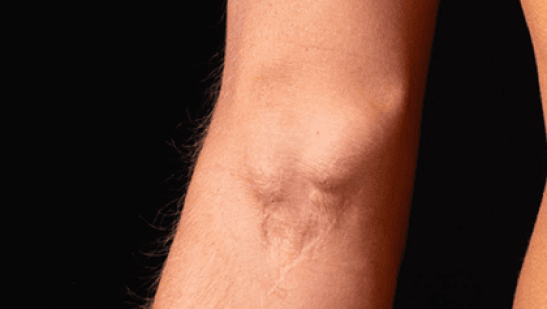 Best Vascular Surgeon In Delhi