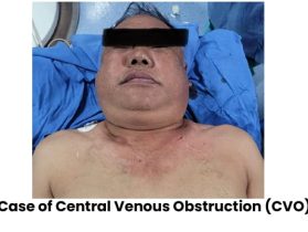 Before and after results in vascular surgery gallery – Dr. Nikhil Chaudhari, Delhi