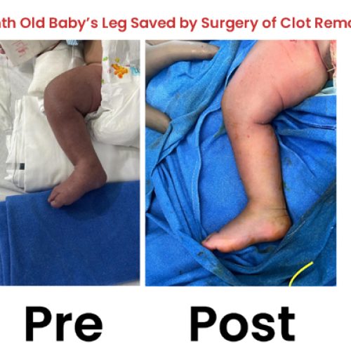 Vascular Treatment Photo Gallery