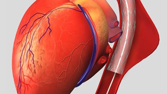 Best Vascular Surgeon In Delhi